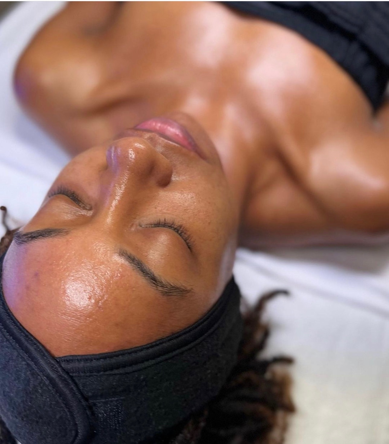 Read more about the article Von Schatten zu Licht: Chemisches Peeling erweckt deinen Intimbereich und Achseln zum Strahlen